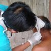 Dinkes Blora Catat 71 Kasus Kusta, Ada Anak-Anak